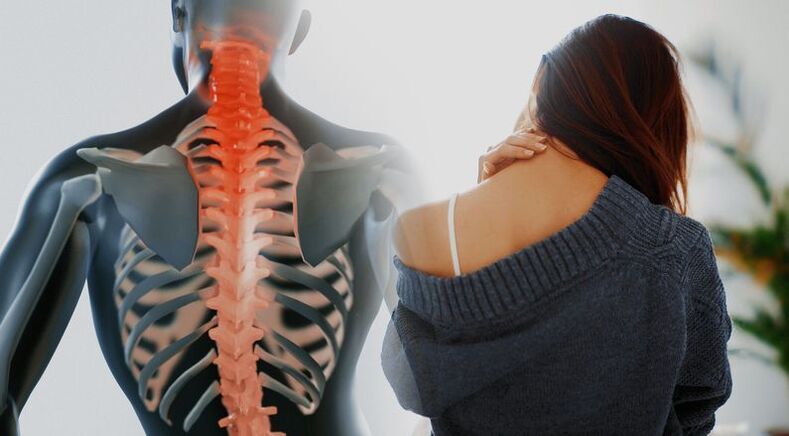 hernia vertebral en el cuello